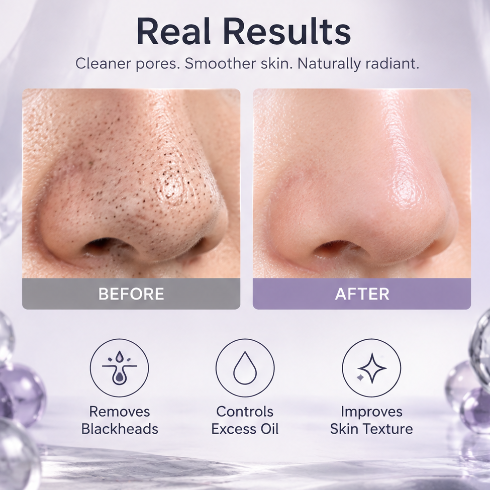 PURELIH Electric Pore Blackhead Remover